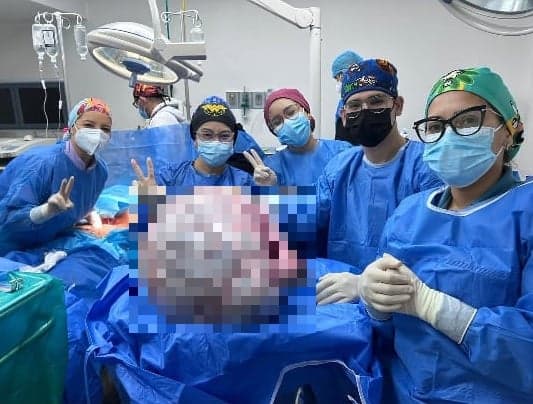 Cirujanos del Hospital Razetti logran retirar tumor de 25,5 kg en Anzoátegui