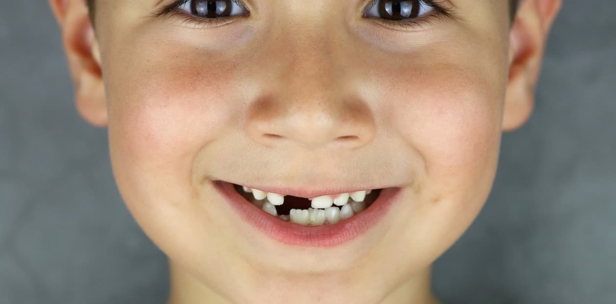 ¿Por qué científicos de Ohio buscan dientes de leche? La sorprendente razón